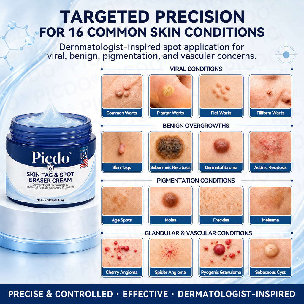 𝐏𝐢𝐜𝐝𝐨® 7-𝐃𝐚𝐲 𝐒𝐤𝐢𝐧 𝐓𝐚𝐠 & 𝐒𝐩𝐨𝐭 𝐄𝐫𝐚𝐬𝐞𝐫 𝐂𝐫𝐞𝐚𝐦🩵 (Zero Pain, Zero 𝐒𝐜𝐚𝐫𝐬 Formula) 💎